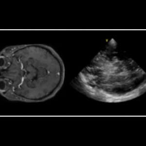 Curso Prático De Ultrassom No Paciente Neurocrítico